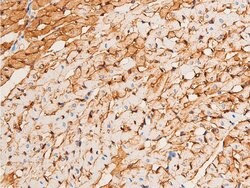 Invitrogen Phospho-Chk1 (Ser296) Polyclonal Antibody 100 &mu;L | Buy Online | Invitrogen&trade; | Fisher Scientific