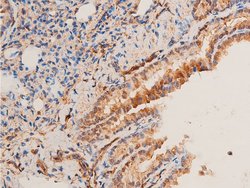 Invitrogen Phospho-Chk1 (Ser296) Polyclonal Antibody 100 &mu;L | Buy Online | Invitrogen&trade; | Fisher Scientific