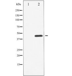 Invitrogen Phospho-Chk1 (Ser296) Polyclonal Antibody 100 &mu;L | Buy Online | Invitrogen&trade; | Fisher Scientific