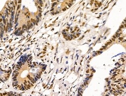 Invitrogen HDAC7 Polyclonal Antibody 100 &mu;L; Unconjugated:Antibodies,