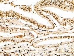 Invitrogen HDAC7 Polyclonal Antibody 100 &mu;L; Unconjugated:Antibodies,