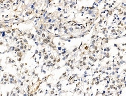 Invitrogen HDAC7 Polyclonal Antibody 100 &mu;L; Unconjugated:Antibodies,