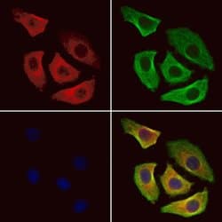 Invitrogen CDC25B Polyclonal Antibody 100 &mu;L; Unconjugated:Antibodies,