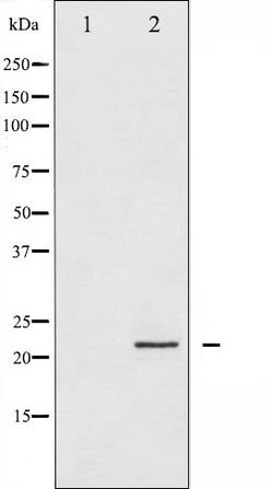 Invitrogen CPI-17 alpha Polyclonal Antibody 100 &mu;L; Unconjugated:Antibodies,