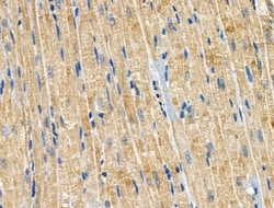 Invitrogen CCS Polyclonal Antibody 100 &mu;L; Unconjugated:Antibodies,