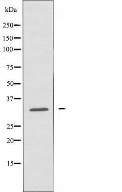 Invitrogen CCS Polyclonal Antibody 100 &mu;L; Unconjugated:Antibodies,