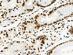 Invitrogen Phospho-CD227 (Mucin 1) (Tyr1229) Polyclonal Antibody 100 &mu;L | Buy Online | Invitrogen&trade; | Fisher Scientific