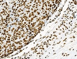 Invitrogen Phospho-CD227 (Mucin 1) (Tyr1229) Polyclonal Antibody 100 &mu;L | Buy Online | Invitrogen&trade; | Fisher Scientific