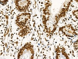 Invitrogen Phospho-CD227 (Mucin 1) (Tyr1229) Polyclonal Antibody 100 &mu;L | Buy Online | Invitrogen&trade; | Fisher Scientific
