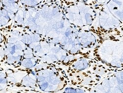 Invitrogen Phospho-CD227 (Mucin 1) (Tyr1229) Polyclonal Antibody 100 &mu;L | Buy Online | Invitrogen&trade; | Fisher Scientific