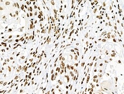 Invitrogen Phospho-CD227 (Mucin 1) (Tyr1229) Polyclonal Antibody 100 &mu;L | Buy Online | Invitrogen&trade; | Fisher Scientific