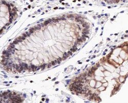 Invitrogen Phospho-CD227 (Mucin 1) (Tyr1229) Polyclonal Antibody 100 &mu;L | Buy Online | Invitrogen&trade; | Fisher Scientific