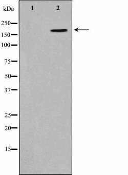 Invitrogen Phospho-CD227 (Mucin 1) (Tyr1229) Polyclonal Antibody 100 &mu;L | Buy Online | Invitrogen&trade; | Fisher Scientific