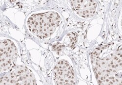 CDKN2B Polyclonal Antibody:Antibodies, Polyclonal