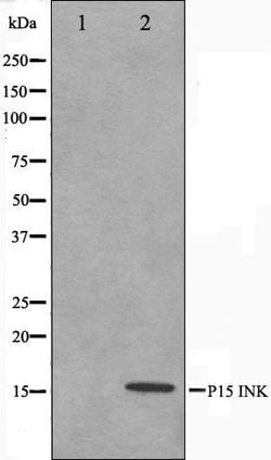 CDKN2B Polyclonal Antibody:Antibodies, Polyclonal
