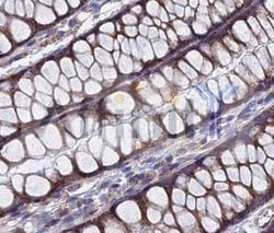 Invitrogen TGF alpha Polyclonal Antibody 100 &mu;L; Unconjugated:Antibodies,