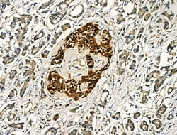 Invitrogen TGF alpha Polyclonal Antibody 100 &mu;L; Unconjugated:Antibodies,