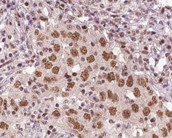Invitrogen XRN2 Polyclonal Antibody 100 &mu;L; Unconjugated:Antibodies,