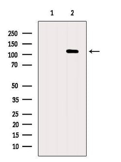 Invitrogen XRN2 Polyclonal Antibody 100 &mu;L; Unconjugated:Antibodies,