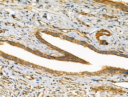 Invitrogen HGK Polyclonal Antibody 100 &mu;L; Unconjugated:Antibodies,