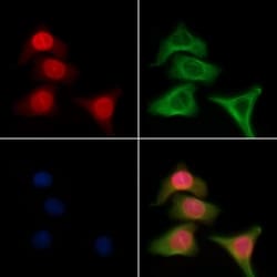 Invitrogen GTF2H2 Polyclonal Antibody 100 &mu;L; Unconjugated:Antibodies,