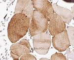 CDKN2C Polyclonal Antibody, Invitrogen™