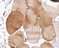 CDKN2C Polyclonal Antibody, Invitrogen 100 &mu;L; Unconjugated:Antibodies,