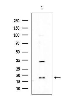 CDKN2C Polyclonal Antibody, Invitrogen 100 &mu;L; Unconjugated:Antibodies,