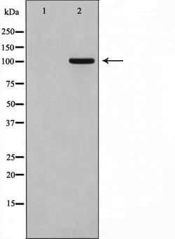 Invitrogen&trade;&nbsp;GPRIN1 Polyclonal Antibody