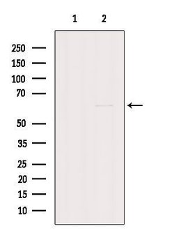 Invitrogen GK2 Polyclonal Antibody 100 &mu;L; Unconjugated:Antibodies,
