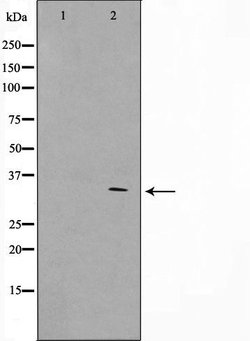 Invitrogen GFR alpha-4 Polyclonal Antibody 100 &mu;L | Buy Online | Invitrogen&trade; | Fisher Scientific