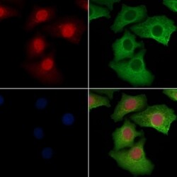 Phospho-ERK1/ERK2 (Thr202, Tyr204) Polyclonal Antibody, Invitrogen 100