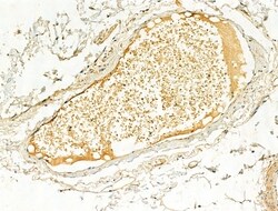 Phospho-ERK1/ERK2 (Thr202, Tyr204) Polyclonal Antibody, Invitrogen 100