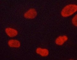 Phospho-ERK1/ERK2 (Thr202, Tyr204) Polyclonal Antibody, Invitrogen 100