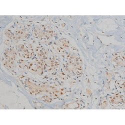 Phospho-ERK1/ERK2 (Thr202, Tyr204) Polyclonal Antibody, Invitrogen 100