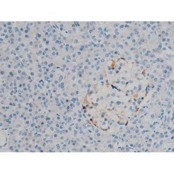 Phospho-ERK1/ERK2 (Thr202, Tyr204) Polyclonal Antibody, Invitrogen 100