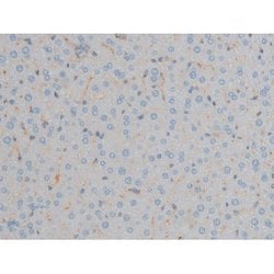 Phospho-ERK1/ERK2 (Thr202, Tyr204) Polyclonal Antibody, Invitrogen 100