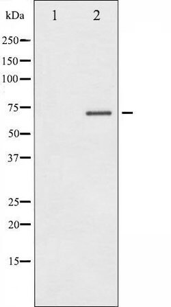 Invitrogen Phospho-Estrogen Receptor alpha (Ser104) Polyclonal Antibody