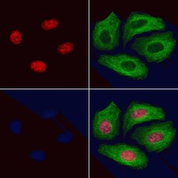 Invitrogen Phospho-GATA1 (Ser310) Polyclonal Antibody 100 &mu;L; Unconjugated:Antibodies,
