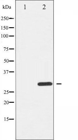 Invitrogen Phospho-BIK (Thr33) Polyclonal Antibody 100 &mu;L | Buy Online | Invitrogen&trade; | Fisher Scientific