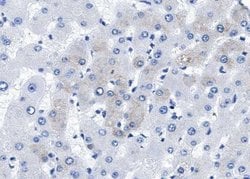 Invitrogen BMP-5 Polyclonal Antibody 100 &mu;L; Unconjugated:Antibodies,
