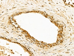 Invitrogen p47phox Polyclonal Antibody 100 &mu;L; Unconjugated:Antibodies,