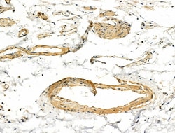 Invitrogen COL4A2 Polyclonal Antibody 100 &mu;L | Buy Online | Invitrogen&trade; | Fisher Scientific