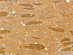 Invitrogen COL4A2 Polyclonal Antibody 100 &mu;L | Buy Online | Invitrogen&trade; | Fisher Scientific