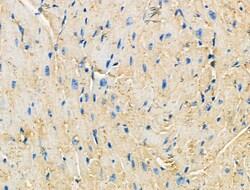Invitrogen CCR7 Polyclonal Antibody 100 &mu;L | Buy Online | Invitrogen&trade; | Fisher Scientific