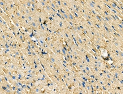 Invitrogen CCR7 Polyclonal Antibody 100 &mu;L | Buy Online | Invitrogen&trade; | Fisher Scientific