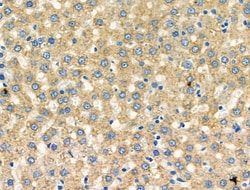 Invitrogen CCR7 Polyclonal Antibody 100 &mu;L | Buy Online | Invitrogen&trade; | Fisher Scientific