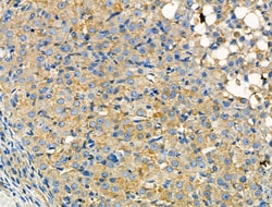 Invitrogen CCR7 Polyclonal Antibody 100 &mu;L | Buy Online | Invitrogen&trade; | Fisher Scientific