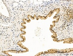 Invitrogen Cyclin A1 Polyclonal Antibody 100 &mu;L; Unconjugated:Antibodies,