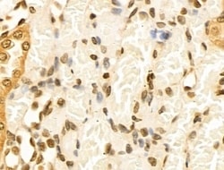 Invitrogen Cyclin A1 Polyclonal Antibody 100 &mu;L; Unconjugated:Antibodies,